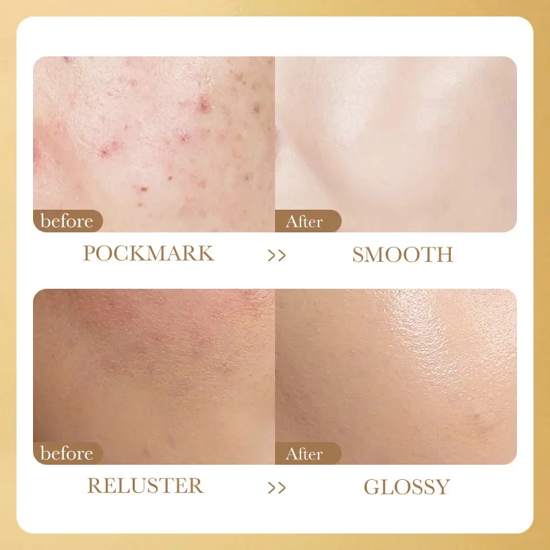 Face Serum Niacinamide Whitening Freeze-Dried Podwer Set Shrink Pores Hydrating Brighten Anti-Aging Anti Wrinkle Skin Care 5